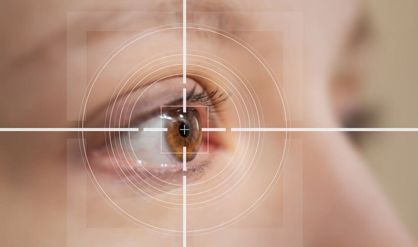 Lasik surgery