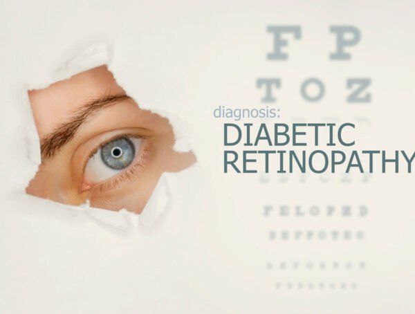 diabetic-retinopathy-resize c