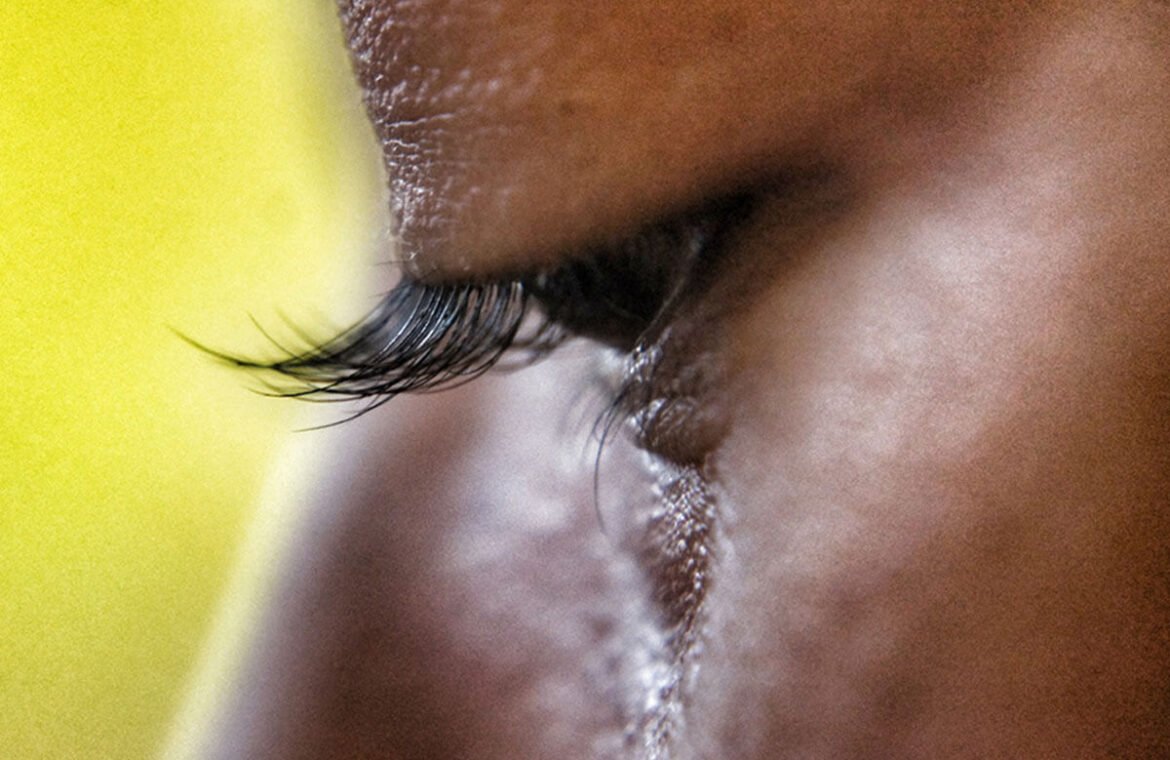 Crocodile Tears-An eye situation you didnt know existed