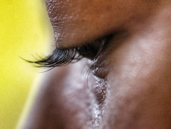 Crocodile Tears-An eye situation you didnt know existed